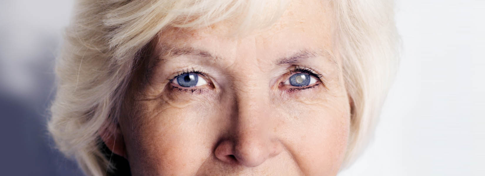 Cataract Surgery in New Castle